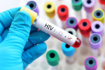 علائم ایدز بعد از روابط جنسی پر خطر چیست؟