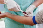 علت بالا و پایین بودن Anti-ds-DNA Ab در آزمایش خون