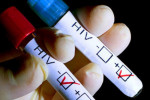 جواب آزمایش ایدز : تفسیر کامل نتایج آزمایش (HIV) ایدز