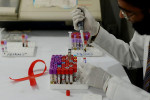 آیا خبر تولید واکسن HIV صحت دارد ؟