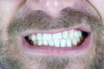 12 ویتامین لازم بدن برای سالم ماندن دندان ها