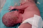 ویدیو | تولد نوزادی عجیب و ترسناک با ۳ سر و ۳ چشم / با دیدنش سر درد میگیرید !!