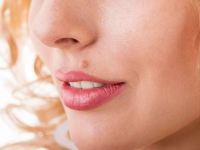 ۱۳ درمان حیرت انگیز خانگی برای از بین بردن خال گوشتی