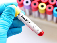 هپاتیت سی : ۸ روش خانگی فوق العاده برای درمان هپاتیت C
