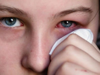 التهاب چشم : ۱۱ راهکار خانگی برای درمان عفونت چشم