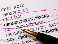 تفاوت اصلی کلسترول با تری گلیسیرید در چیست ؟