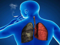آیا ریه ی افراد سیگاری پس از ترک بهبود می یابد ؟