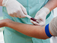آزمایش خون کبد : آیا با آزمایش خون کبد چرب مشخص میشود ؟