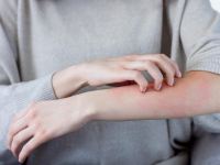 این رژیم غذایی باعث ایجاد عارضه کتو راش می شود