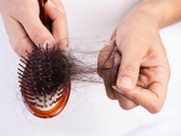 آیا استفاده از نرم کننده باعث ریزش مو می شود؟