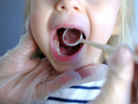 علت سیاهی دندان در کودکان چیست؟