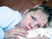 فرق سرخک با سرخجه چیست؟