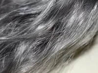 کمبود چه ماده ی غذایی در بدن باعث سفید شدن موها میشود؟