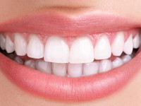 مینی ایمپلنت (mini implant) چیست و چگونه کاشته میشود ؟