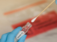 فرق تست PCR با تست آنتی بادی کرونا چیست ؟
