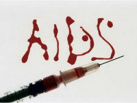 ایدز چه بلاهایی بر سر بدن می آورد؟