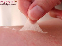 لایه برداری پوست برای شفافی پوست