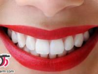 چگونه دندان هایتان را سفید کنید؟