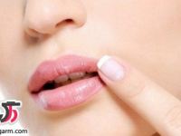 چگونه تبخال لب را سریع خوب کنیم؟