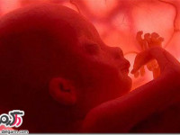 علت خونریزی جنین در رحم مادر چیست؟