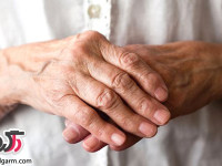 همه چیز در مورد عارضه روماتولوژی