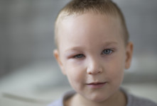  سلولیت چشمی در کودکان + علایم دلایل و درمان های خانگی