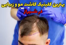 بهترین کلینیک کاشت مو و زیبایی در شیراز