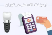 ایمپلنت با اقساط بلند مدت بدون سود