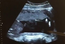اهنگ برای هوش نوزاد و جنین در شکم از موتزارت با کیفیت بالا