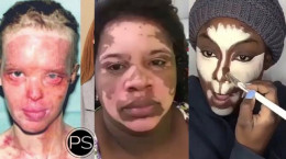میکاپ شگفت انگیز صورت های آسیب دیده توسط برترین گریمورها