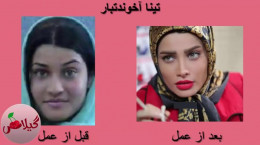 ویدیو باورنکردنی از قبل و بعد عمل زیبایی بازیگران