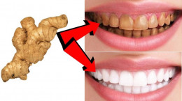سفید کردن دندان ها با زنجبیل