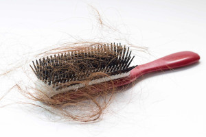 5 راه تشخیص و پیشگیری از ریزش مو و 2 راه درمان خانگی