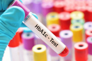 علت بالا و پایین بودن hba1c در آزمایش خون