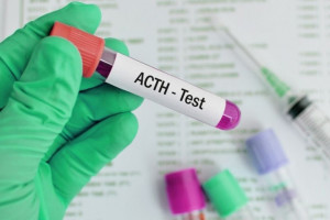 علت بالا و پایین بودن acth در آزمایش خون