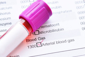 علت بالا و پایین بودن ABG در آزمایش خون