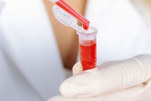 علت بالا و پایین بودن C۲ در آزمایش خون