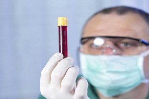علت بالا و پایین بودن در Cp آزمایش خون
