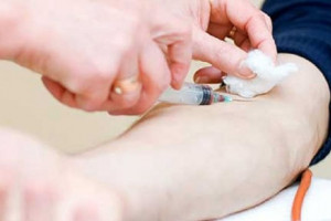 علت بالا و پایین بودن fibrinogen در آزمایش خون