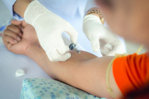 علت مثبت و منفی بودن HDV-Ab در آزمایش خون