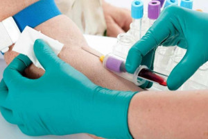 علت بالا و پایین بودن HBEL در آزمایش خون 