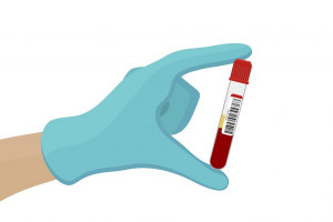 علت بالا و پایین بودن PHB در آزمایش خون 