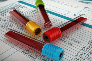 سطح MCH در آزمایش خون چه معنایی دارد ؟