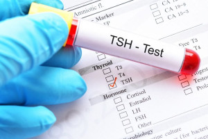 tsh در آزمایش خون نشان دهنده تیروئید پر کار است یا کم کار ؟