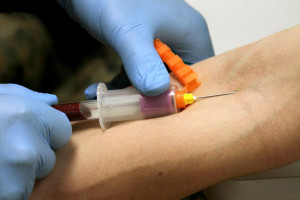 آزمایش خون SGOT یا AST نشانگر چه بیماریهایی میباشد ؟