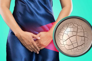 ۱۰ علت اصلی خشکی واژن هنگام دخول + ۷ درمان قطعی این عارضه