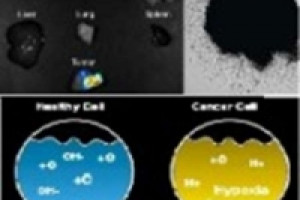 نانو پیمایشگر ؛و شناسایی سلول های سرطانی