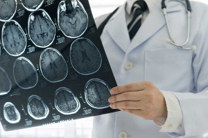 متخصص مغز و اعصاب با جراح مغز و اعصاب چه فرقی دارد؟
