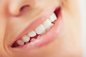 علت و درمان کراودینگ یا نامرتبی دندانها