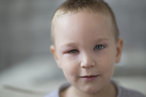  سلولیت چشمی در کودکان + علایم دلایل و درمان های خانگی